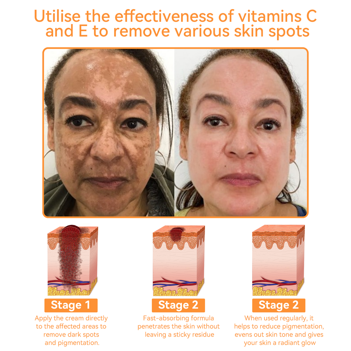 🔴𝐃𝐨𝐫𝐦𝐨𝐫𝐧𝐚™ 𝐀𝐥𝐥-𝐁𝐨𝐝𝐲 𝐒𝐤𝐢𝐧 𝐓𝐫𝐞𝐚𝐭𝐦𝐞𝐧𝐭 𝐂𝐫𝐞𝐚𝐦 𝐁𝐞𝐞 𝐯𝐞𝐧𝐨𝐦 𝐜𝐫𝐞𝐚𝐦 𝐟𝐨𝐫 𝐚𝐥𝐥 𝐭𝐲𝐩𝐞𝐬 𝐨𝐟 𝐟𝐮𝐧𝐠𝐚𝐥 𝐰𝐫𝐢𝐧𝐤𝐥𝐞𝐬 𝐚𝐧𝐝 𝐬𝐜𝐚𝐫𝐬 𝐚𝐥𝐥 𝐨𝐯𝐞𝐫 𝐭𝐡𝐞 𝐛𝐨𝐝𝐲