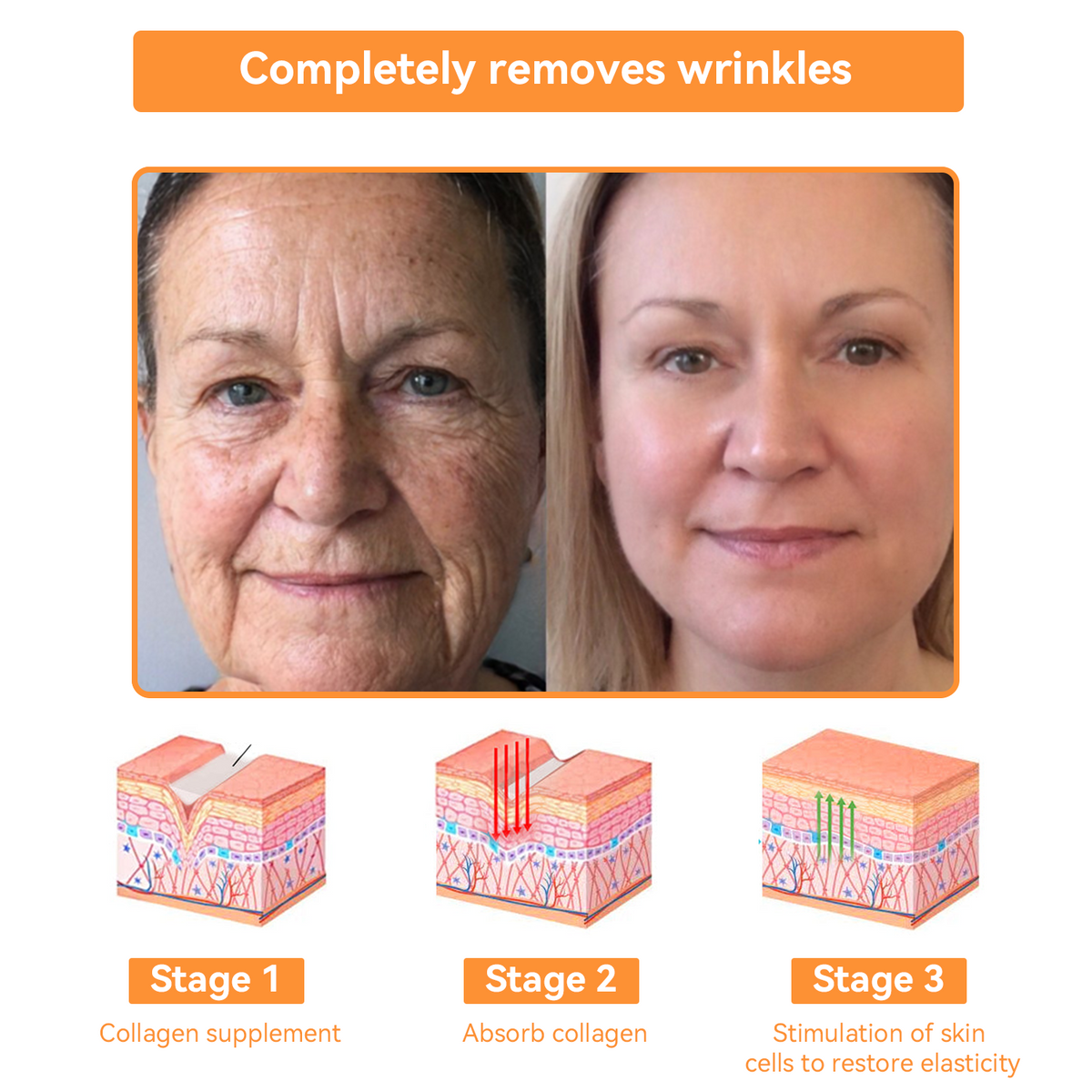 🔴𝐃𝐨𝐫𝐦𝐨𝐫𝐧𝐚™ 𝐀𝐥𝐥-𝐁𝐨𝐝𝐲 𝐒𝐤𝐢𝐧 𝐓𝐫𝐞𝐚𝐭𝐦𝐞𝐧𝐭 𝐂𝐫𝐞𝐚𝐦 𝐁𝐞𝐞 𝐯𝐞𝐧𝐨𝐦 𝐜𝐫𝐞𝐚𝐦 𝐟𝐨𝐫 𝐚𝐥𝐥 𝐭𝐲𝐩𝐞𝐬 𝐨𝐟 𝐟𝐮𝐧𝐠𝐚𝐥 𝐰𝐫𝐢𝐧𝐤𝐥𝐞𝐬 𝐚𝐧𝐝 𝐬𝐜𝐚𝐫𝐬 𝐚𝐥𝐥 𝐨𝐯𝐞𝐫 𝐭𝐡𝐞 𝐛𝐨𝐝𝐲