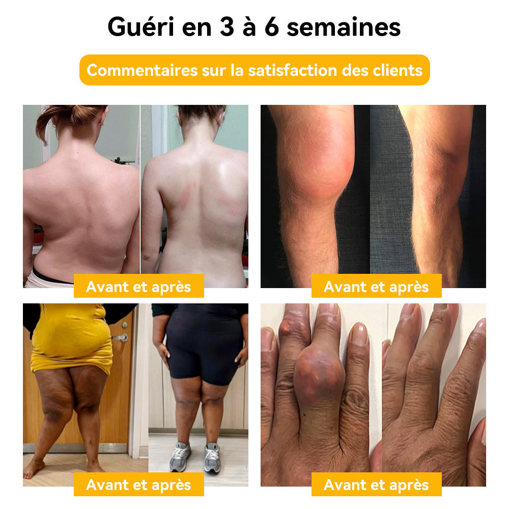 𝐒𝐩𝐳𝐯™ 𝐕𝐞𝐧𝐢𝐧 𝐝'𝐚𝐛𝐞𝐢𝐥𝐥𝐞 𝐂𝐫è𝐦𝐞 𝐝𝐞 𝐭𝐫𝐚𝐢𝐭𝐞𝐦𝐞𝐧𝐭 𝐝𝐞𝐬 𝐚𝐫𝐭𝐢𝐜𝐮𝐥𝐚𝐭𝐢𝐨𝐧𝐬 𝐞𝐭 𝐝𝐞𝐬 𝐨𝐬 🐝(𝐍𝐞𝐰 𝐙𝐞𝐚𝐥𝐚𝐧𝐝 𝐁𝐞𝐞 𝐄𝐱𝐭𝐫𝐚𝐜𝐭 𝐞𝐬𝐭 𝐬𝐩é𝐜𝐢𝐚𝐥𝐢𝐬é 𝐝𝐚𝐧𝐬 𝐥𝐞𝐬 𝐦𝐚𝐥𝐚𝐝𝐢𝐞𝐬 𝐨𝐫𝐭𝐡𝐨𝐩é𝐝𝐢𝐪𝐮𝐞𝐬 𝐞𝐭 𝐥𝐞𝐬 𝐝𝐨𝐮𝐥𝐞𝐮𝐫𝐬 𝐚𝐫𝐭𝐡𝐫𝐢𝐭𝐢𝐪𝐮𝐞𝐬)