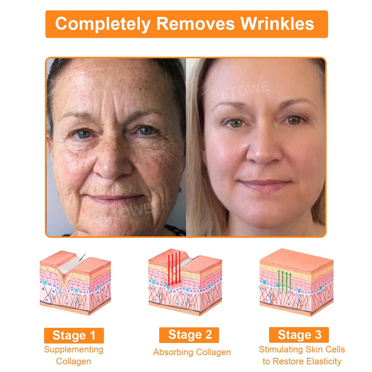 Dormorna™ Powerful All-Body Skin Treatment Cream(ADD Recommended)🎄