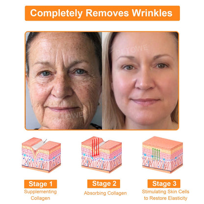 Dormorna™ Powerful All-Body Skin Treatment Cream(ADD Recommended)🎄