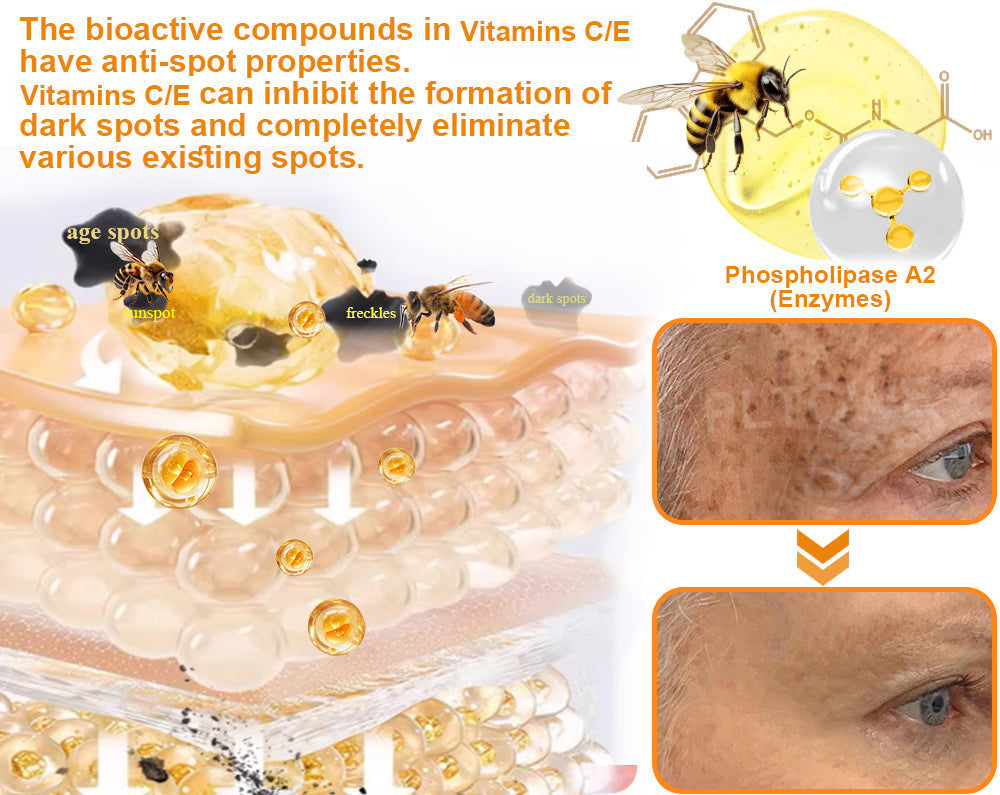 Dormorna™ Powerful All-Body Skin Treatment Cream(ADD Recommended)🎄