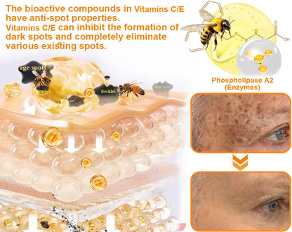 Dormorna™ Powerful All-Body Skin Treatment Cream(ADD Recommended)🎄