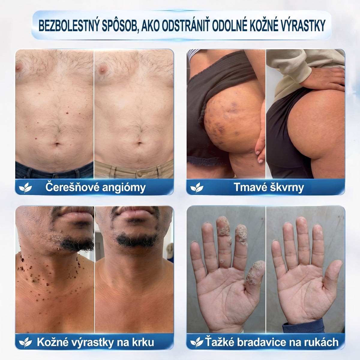 𝐏𝒊𝐜𝐝𝒐® 👩‍⚕️🌍7-𝑫ň𝒐𝒗ý 𝑵𝒂 𝑶𝒅𝒔𝒕𝒓𝒂ň𝒐𝒗𝒂𝒏𝒊𝒆 𝑷𝒊𝒈𝒎𝒆𝒏𝒕𝒐𝒗ý𝒄𝒉 Š𝒌𝒗ŕ𝒏 𝑨 𝑱𝒂𝒛𝒊𝒆𝒗 𝑷𝒆𝒓𝒐(𝐵𝑒𝑧 𝑏𝑜𝑙𝑒𝑠𝑡𝑖, 𝑏𝑒𝑧 𝑗𝑎𝑧𝑖𝑒𝑣 – 𝑟𝑜𝑙𝑙𝑒𝑟𝑏𝑎𝑙𝑙)
