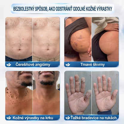 𝐏𝒊𝐜𝐝𝒐® 👩‍⚕️🌍7-𝑫ň𝒐𝒗ý 𝑵𝒂 𝑶𝒅𝒔𝒕𝒓𝒂ň𝒐𝒗𝒂𝒏𝒊𝒆 𝑷𝒊𝒈𝒎𝒆𝒏𝒕𝒐𝒗ý𝒄𝒉 Š𝒌𝒗ŕ𝒏 𝑨 𝑱𝒂𝒛𝒊𝒆𝒗 𝑷𝒆𝒓𝒐(𝐵𝑒𝑧 𝑏𝑜𝑙𝑒𝑠𝑡𝑖, 𝑏𝑒𝑧 𝑗𝑎𝑧𝑖𝑒𝑣 – 𝑟𝑜𝑙𝑙𝑒𝑟𝑏𝑎𝑙𝑙)