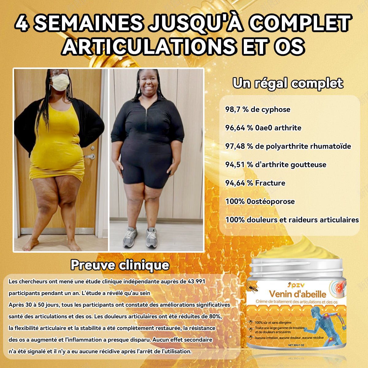 𝐒𝐩𝐳𝐯™ 𝐕𝐞𝐧𝐢𝐧 𝐝'𝐚𝐛𝐞𝐢𝐥𝐥𝐞 𝐂𝐫è𝐦𝐞 𝐝𝐞 𝐭𝐫𝐚𝐢𝐭𝐞𝐦𝐞𝐧𝐭 𝐝𝐞𝐬 𝐚𝐫𝐭𝐢𝐜𝐮𝐥𝐚𝐭𝐢𝐨𝐧𝐬 𝐞𝐭 𝐝𝐞𝐬 𝐨𝐬 🐝(𝐍𝐞𝐰 𝐙𝐞𝐚𝐥𝐚𝐧𝐝 𝐁𝐞𝐞 𝐄𝐱𝐭𝐫𝐚𝐜𝐭 𝐞𝐬𝐭 𝐬𝐩é𝐜𝐢𝐚𝐥𝐢𝐬é 𝐝𝐚𝐧𝐬 𝐥𝐞𝐬 𝐦𝐚𝐥𝐚𝐝𝐢𝐞𝐬 𝐨𝐫𝐭𝐡𝐨𝐩é𝐝𝐢𝐪𝐮𝐞𝐬 𝐞𝐭 𝐥𝐞𝐬 𝐝𝐨𝐮𝐥𝐞𝐮𝐫𝐬 𝐚𝐫𝐭𝐡𝐫𝐢𝐭𝐢𝐪𝐮𝐞𝐬)