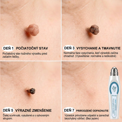 𝐏𝒊𝐜𝐝𝒐® 👩‍⚕️🌍7-𝑫ň𝒐𝒗ý 𝑵𝒂 𝑶𝒅𝒔𝒕𝒓𝒂ň𝒐𝒗𝒂𝒏𝒊𝒆 𝑷𝒊𝒈𝒎𝒆𝒏𝒕𝒐𝒗ý𝒄𝒉 Š𝒌𝒗ŕ𝒏 𝑨 𝑱𝒂𝒛𝒊𝒆𝒗 𝑷𝒆𝒓𝒐(𝐵𝑒𝑧 𝑏𝑜𝑙𝑒𝑠𝑡𝑖, 𝑏𝑒𝑧 𝑗𝑎𝑧𝑖𝑒𝑣 – 𝑟𝑜𝑙𝑙𝑒𝑟𝑏𝑎𝑙𝑙)