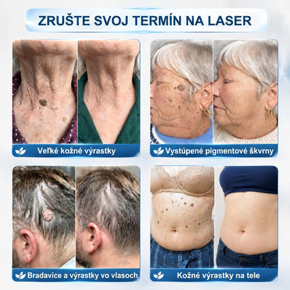 𝐏𝒊𝐜𝐝𝒐® 👩‍⚕️🌍7-𝑫ň𝒐𝒗ý 𝑵𝒂 𝑶𝒅𝒔𝒕𝒓𝒂ň𝒐𝒗𝒂𝒏𝒊𝒆 𝑷𝒊𝒈𝒎𝒆𝒏𝒕𝒐𝒗ý𝒄𝒉 Š𝒌𝒗ŕ𝒏 𝑨 𝑱𝒂𝒛𝒊𝒆𝒗 𝑷𝒆𝒓𝒐(𝐵𝑒𝑧 𝑏𝑜𝑙𝑒𝑠𝑡𝑖, 𝑏𝑒𝑧 𝑗𝑎𝑧𝑖𝑒𝑣 – 𝑟𝑜𝑙𝑙𝑒𝑟𝑏𝑎𝑙𝑙)